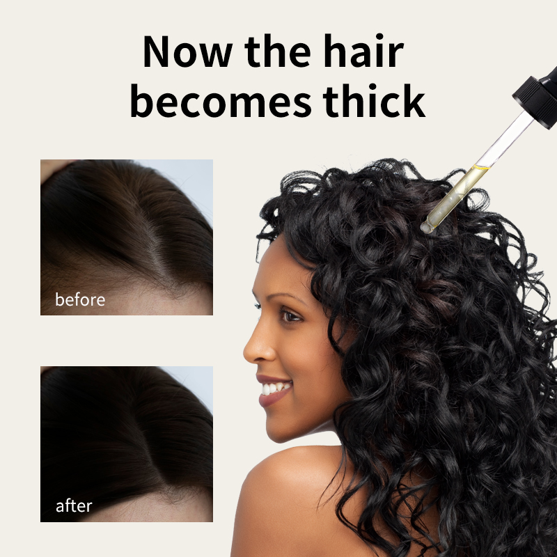 Dầu mọc tóc Syulli | Dầu chống rụng tóc hương thảo & gừng | Kích thích nang trứng