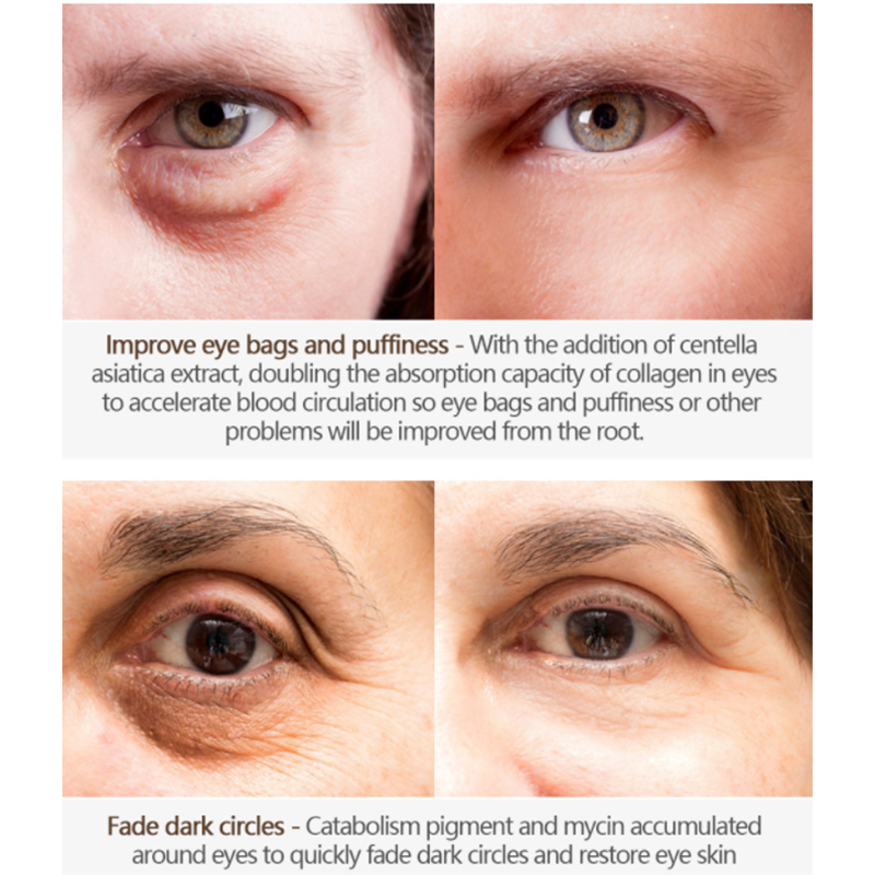 Kem Chống Nhăn Mắt T&ugrave;y Chỉnh Với Đầu Phun (2) 